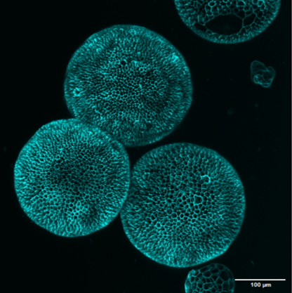 Colorectal_cancer_organoids2_300